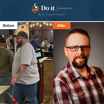 Slider image (4) Do It Bariatrics